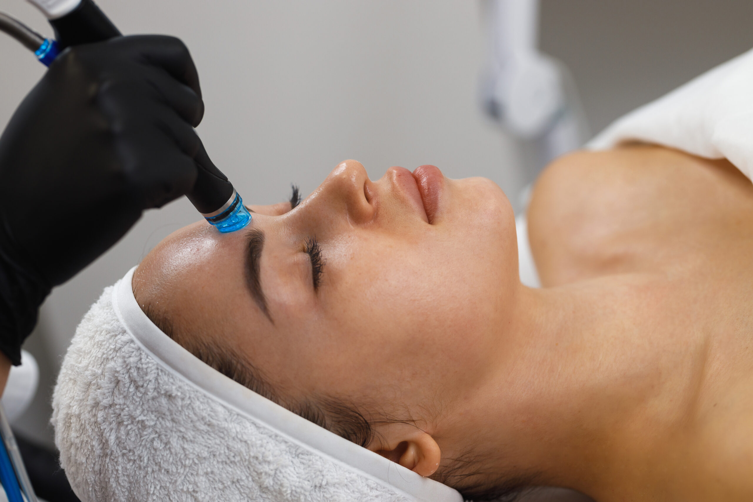 Avara Spa Dermapen microneedling Cape Town
