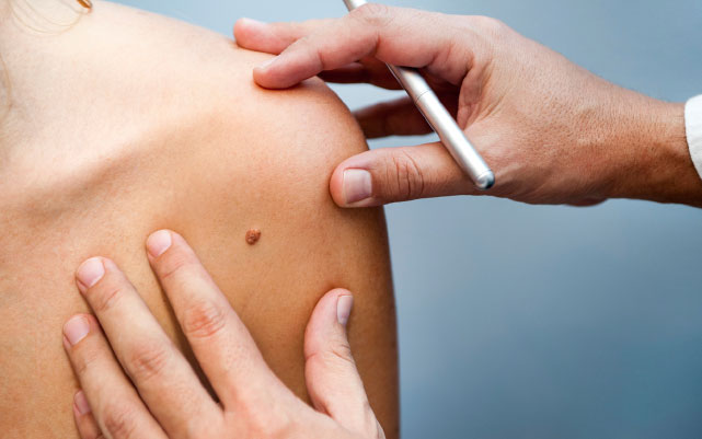 Soma Laser hair removal Pretoria